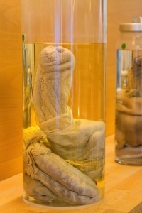 Phallological Museum